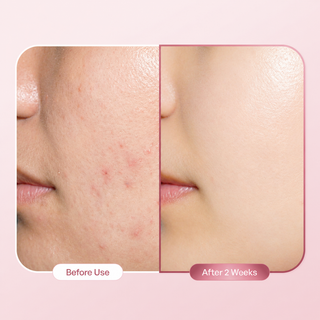 Plantifique Brightening Niacinamide Face Serum 30ml | 10% Niacinamide, Tranexamic Acid & Phyto-PDRN